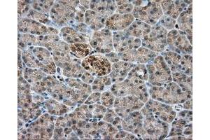 Immunohistochemical staining of paraffin-embedded colon tissue using anti-PIM2 mouse monoclonal antibody. (PIM2 antibody)