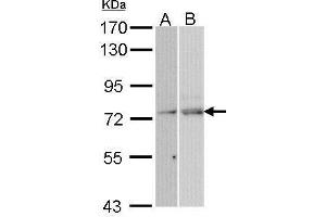 Western blot analysis of 30 ug of whole cell lysate (A: Hela; B: Molt-4) using a 7.