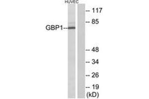 Western blot analysis of extracts from HuvEc cells, using GBP1 Antibody. (GBP1 antibody  (AA 71-120))