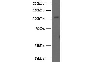 ABIN2563976 (2µg/ml) staining of Human T-lymphocyte lysate (35µg protein in RIPA buffer). (UNC13D antibody  (Internal Region))