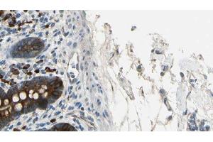ABIN6267367 at 1/100 staining Mouse intestine tissue by IHC-P. (BCR antibody  (pTyr360))