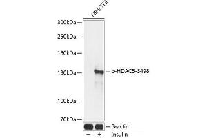 Western blot analysis of extracts of NIH/3T3 cells using Phospho-HDAC5(S498) Polyclonal Antibody at dilution of 1:2000. (HDAC5 antibody  (pSer498))