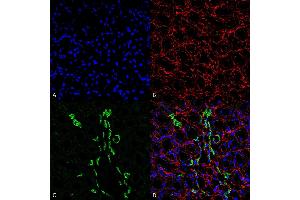 Immunohistochemistry analysis using Rabbit Anti-UT-A1 Polyclonal Antibody (ABIN2486314). (Solute Carrier Family 14 (Urea Transporter, Kidney) Member 2 (SLC14A2) (AA 911-929) antibody (PE))