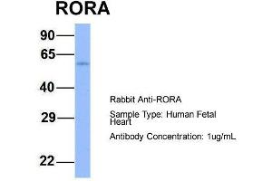 Host:  Rabbit  Target Name:  RORA  Sample Type:  Human Fetal Heart  Antibody Dilution:  1.