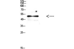 Western Blot analysis of mouse brain cells using Antibody diluted at 1:500. (E2F1 antibody  (AA 100-170))