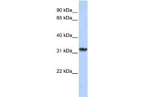 WB Suggested Anti-SMNDC1 Antibody Titration:  0. (SMNDC1 antibody  (C-Term))
