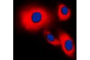 Immunofluorescent analysis of CDC25B staining in THP1 cells. (CDC25B antibody  (Center))