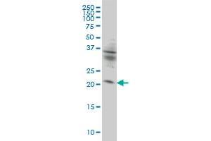 KIF26A monoclonal antibody (M01), clone 3C10 Western Blot analysis of KIF26A expression in HeLa .