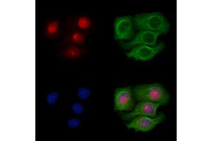 ABIN6256382 and ABIN6267095 staining Heat-shock treated Hela cells by IF/ICC. (BAP1 antibody  (pSer592))
