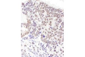 Immunohistochemistry (IHC) image for anti-serine/arginine-Rich Splicing Factor 6 (SRSF6) (AA 250-300) antibody (ABIN7454941) (SFRS6 antibody  (AA 250-300))