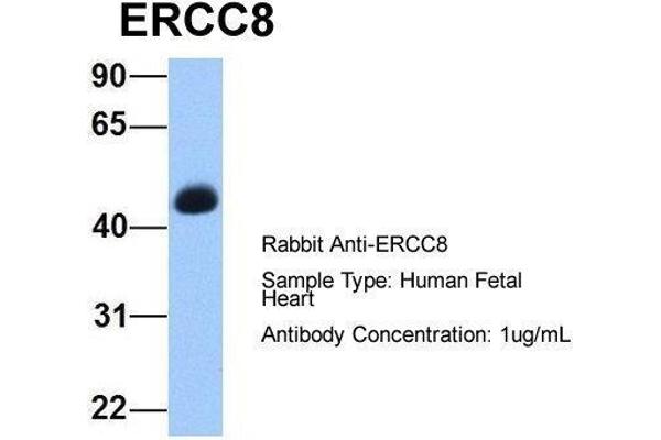 ERCC8 antibody  (C-Term)