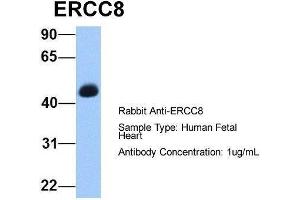 Host:  Rabbit  Target Name:  ERCC8  Sample Type:  Human Fetal Heart  Antibody Dilution:  1. (ERCC8 antibody  (C-Term))