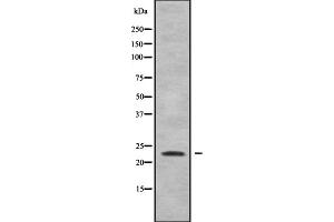 Western blot analysis of Rho G using Jurkat whole cell lysates (RHOG antibody  (Internal Region))