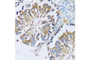 Immunohistochemistry (IHC) image for anti-Calcium Binding Protein 7 (CABP7) (AA 100-180) antibody (ABIN6137807)