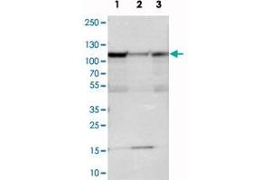 Western blot analysis of cell lysates with SMEK1 polyclonal antibody .
