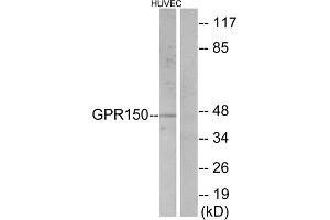 Western blot analysis of extracts from HUVEC cells, using GPR150 antibody.
