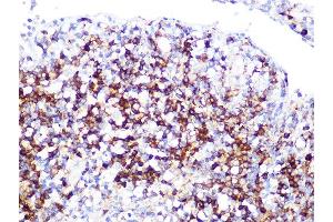 Immunohistochemistry of paraffin-embedded human appendix using LDHB Rabbit mAb (ABIN7268170) at dilution of 1:100 (40x lens).