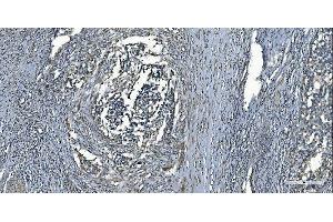 IHC analysis of MCU using anti-MCU antibody (ABIN7601931). (MCU antibody  (AA 51-351))