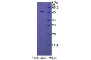 SDS-PAGE (SDS) image for CD46 (CD46) (AA 136-341) protein (His tag,GST tag) (ABIN2123257) (CD46 Protein (CD46) (AA 136-341) (His tag,GST tag))