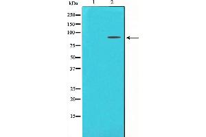 Western blot analysis on LOVO cell lysate using FGFR3 Antibody,The lane on the left is treated with the antigen-specific peptide. (FGFR3 antibody  (C-Term))