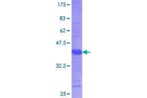 TRPM7 Protein (AA 777-855) (GST tag)