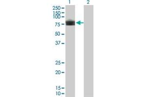 Western Blot analysis of PLXDC1 expression in transfected 293T cell line by PLXDC1 monoclonal antibody (M01), clone 4B10. (PLXDC1 antibody  (AA 313-421))