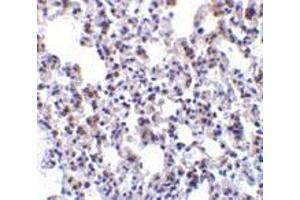 Immunohistochemistry of BAP31 in rat lung tissue with BAP31 antibody at 10 μg/ml.