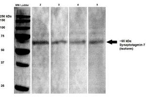 Western Blot analysis of Rat brain lysates showing detection of Synaptotagmin 7 protein using Mouse Anti-Synaptotagmin 7 Monoclonal Antibody, Clone S275-14 . (SYT7 antibody  (AA 150-239) (HRP))