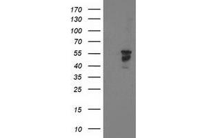 HEK293T cells were transfected with the pCMV6-ENTRY control (Left lane) or pCMV6-ENTRY BECN1 (Right lane) cDNA for 48 hrs and lysed. (Beclin 1 antibody)