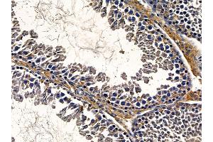 ABIN6258208 and ABIN6273864 at 1/100 staining rat testis tissue by IHC-P.