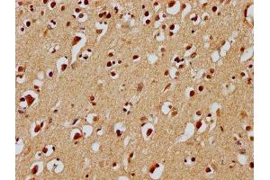 IHC image of ABIN7139932 diluted at 1:100 and staining in paraffin-embedded human brain tissue performed on a Leica BondTM system. (UBE2M antibody  (AA 11-28))
