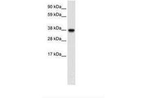 Image no. 1 for anti-N-Myc (And STAT) Interactor (NMI) (AA 66-115) antibody (ABIN202210) (NMI antibody  (AA 66-115))