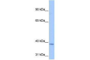 NSUN3 antibody used at 0. (NSUN3 antibody  (C-Term))