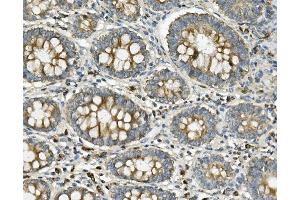 IHC analysis of ME2 using anti-ME2 antibody (ABIN7600967). (NAD-ME antibody  (AA 26-584))