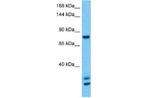Host:  Rabbit  Target Name:  CSF3R  Sample Type:  293T Whole Cell lysates  Antibody Dilution:  1ug/ml
