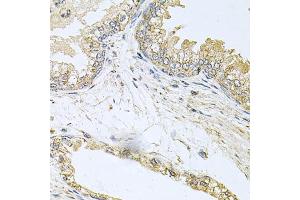 Immunohistochemistry of paraffin-embedded human prostate using BCR antibody.