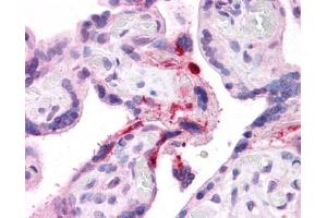 LRRC8B antibody was used for immunohistochemistry at a concentration of 4-8 ug/ml. (LRRC8B antibody  (Middle Region))