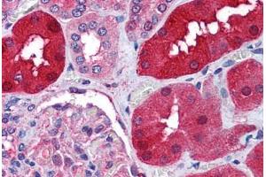 Human Kidney (formalin-fixed, paraffin-embedded) stained with RNF213 antibody ABIN290404 at 1. (RNF213 antibody  (AA 5191-5204))