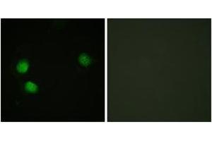 Immunofluorescence analysis of HeLa cells, using Bloom Syndrome (Phospho-Thr99) Antibody. (Bloom Syndrome (AA 65-114), (pThr99) antibody)