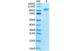 Human LILRB2 on Tris-Bis PAGE under reduced condition. (LILRB2 Protein (AA 22-458) (mFc Tag))