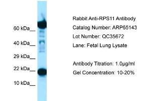 Western Blotting (WB) image for anti-Ribosomal Protein S11 (RPS11) (C-Term) antibody (ABIN2790056) (RPS11 antibody  (C-Term))