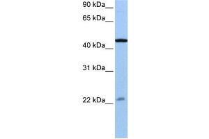 WB Suggested Anti-EWSR1  Antibody Titration: 0. (EWSR1 antibody  (N-Term))