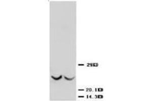Western blot analysis of rat kidney tissue lysis using TIMP3 antibody (TIMP3 antibody  (C-Term))