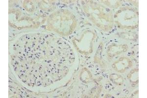 Immunohistochemistry of paraffin-embedded human kidney tissue using ABIN7171040 at dilution of 1:100 (SUSD6 (AA 144-303) antibody)