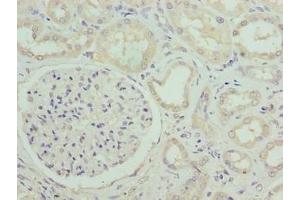 Immunohistochemistry of paraffin-embedded human kidney tissue using ABIN7171040 at dilution of 1:100 (SUSD6 (AA 144-303) antibody)