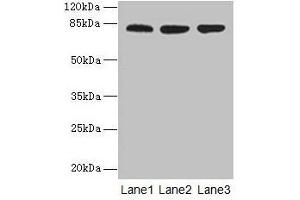 Western blot All lanes: ACAP1 antibody at 4 μg/mL Lane 1: Mouse lung tissue Lane 2: Jurkat whole cell lysate Lane 3: K562 whole cell lysate Secondary Goat polyclonal to rabbit IgG at 1/10000 dilution Predicted band size: 82 kDa Observed band size: 82 kDa (ACAP1 antibody  (AA 1-266))