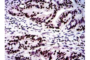 Immunohistochemistry (IHC) image for anti-MutS Homolog 6 (E. Coli) (MSH6) antibody (ABIN969293)