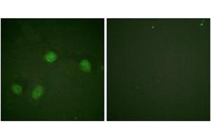 Immunofluorescence analysis of HeLa cells, using C-RAF (Phospho-Ser621) Antibody.