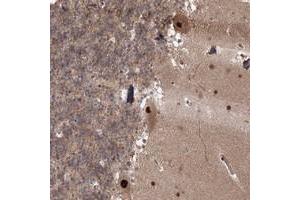 Immunohistochemical staining of human cerebellum with COPS4 polyclonal antibody  shows strong nuclear and cytoplasmic positivity in Purkinje cells at 1:20-1:50 dilution. (COPS4 antibody)