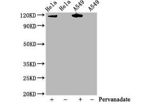 Western Blot Positive WB detected in Hela whole cell lysate,A549 whole cell lysate(treated with Pervanadate or not) All lanes Phospho-JAK2 antibody at 0. (Recombinant JAK2 antibody  (pTyr1007, pTyr1008))